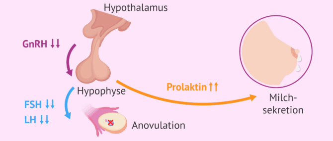 Imagen: Warum verursacht Hyperprolaktinämie endokrine Unfruchtbarkeit?