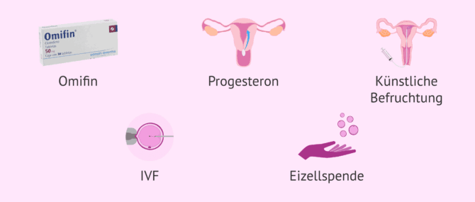 Imagen: Behandlungen zur Erreichung einer Schwangerschaft bei Frauen mit ovarieller Unfruchtbarkeit