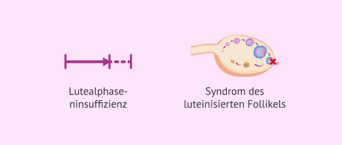 Imagen: Veränderungen im Zusammenhang mit der Lutealphase