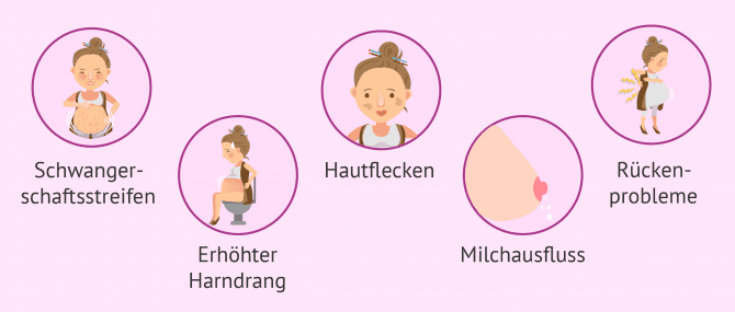 Imagen: Symptome im 6. Schwangerschaftsmonat