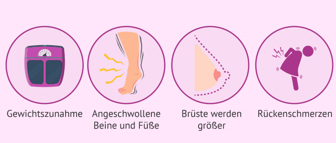 Imagen: Symptome im fünften Monat