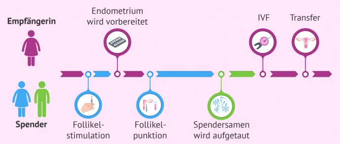 IVF mit Eizellen- und Samenspende: Ablauf und Kosten