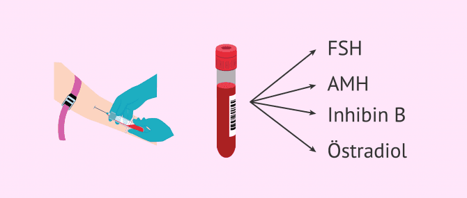 Imagen: Blutbild zur Bestimmung der Eizellenreserve