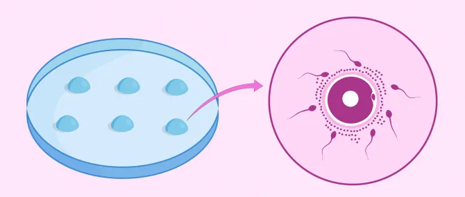 Imagen: Petrischale, in der die klassische IVF durchgeführt wird
