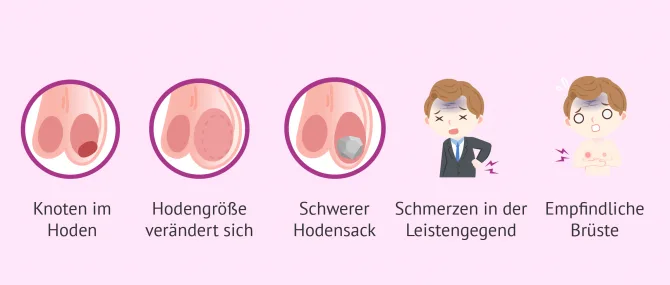 Imagen: Symptome bei Hodenkrebs