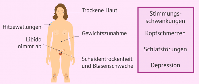 Imagen: Symptome bei der vorzeitigen Menopause