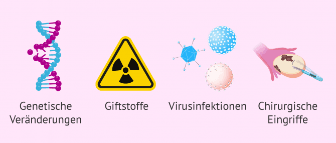 Imagen: Ursachen vorzeitige Menopause