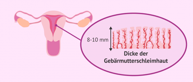 Imagen: Gebärmutterschleimhaut Dicke