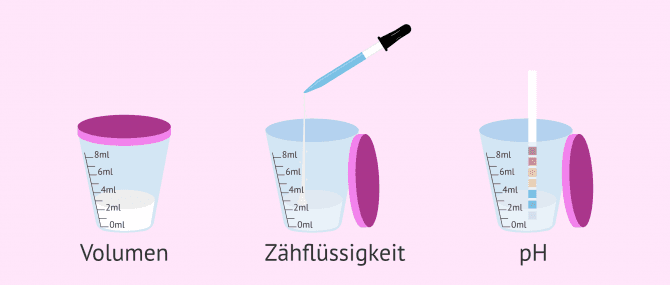 Imagen: Makroskopische Parameter des Spermiogramms