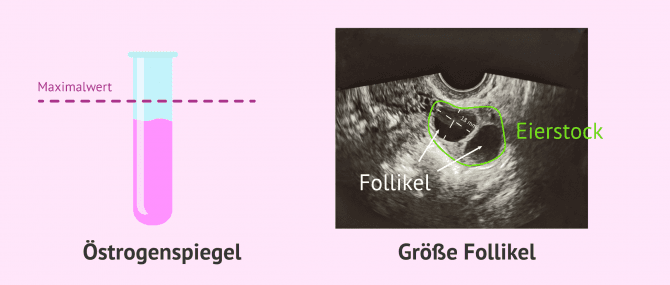 Imagen: medizinische Kontrolle bei der Follikelstimulation