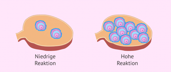 Imagen: Reaktion bei Stimulation