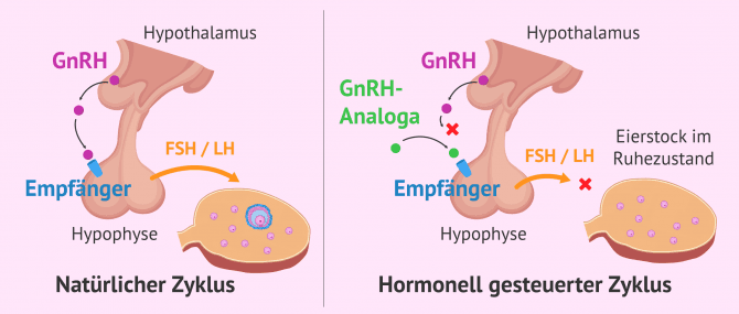 Imagen: Funktionsweise von GnRH-Analogen