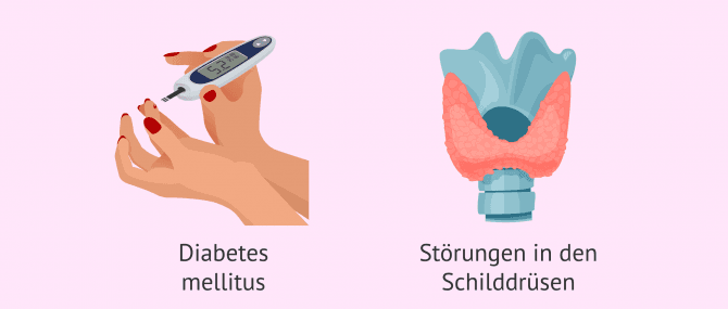 Imagen: Hormonerkrankungen bei der Schwangerschaft