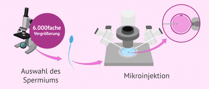 Imagen: IMSI Verfahren