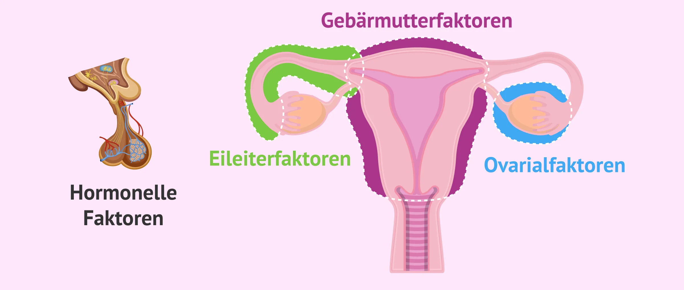 Krankheiten, die zu Unfruchtbarkeit bei Frauen führen: Warnzeichen