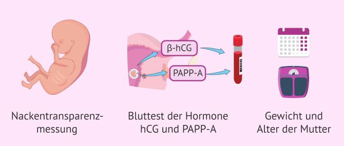 Imagen: Triple-Test im ersten Trimester