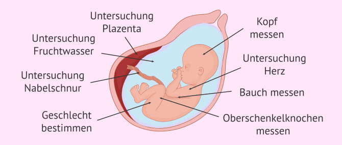 Imagen: Morphologischer Ultraschall im zweiten Trimester