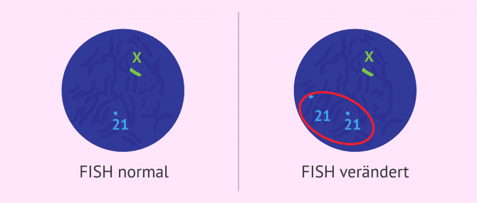 Imagen: FISH-Test in Spermien