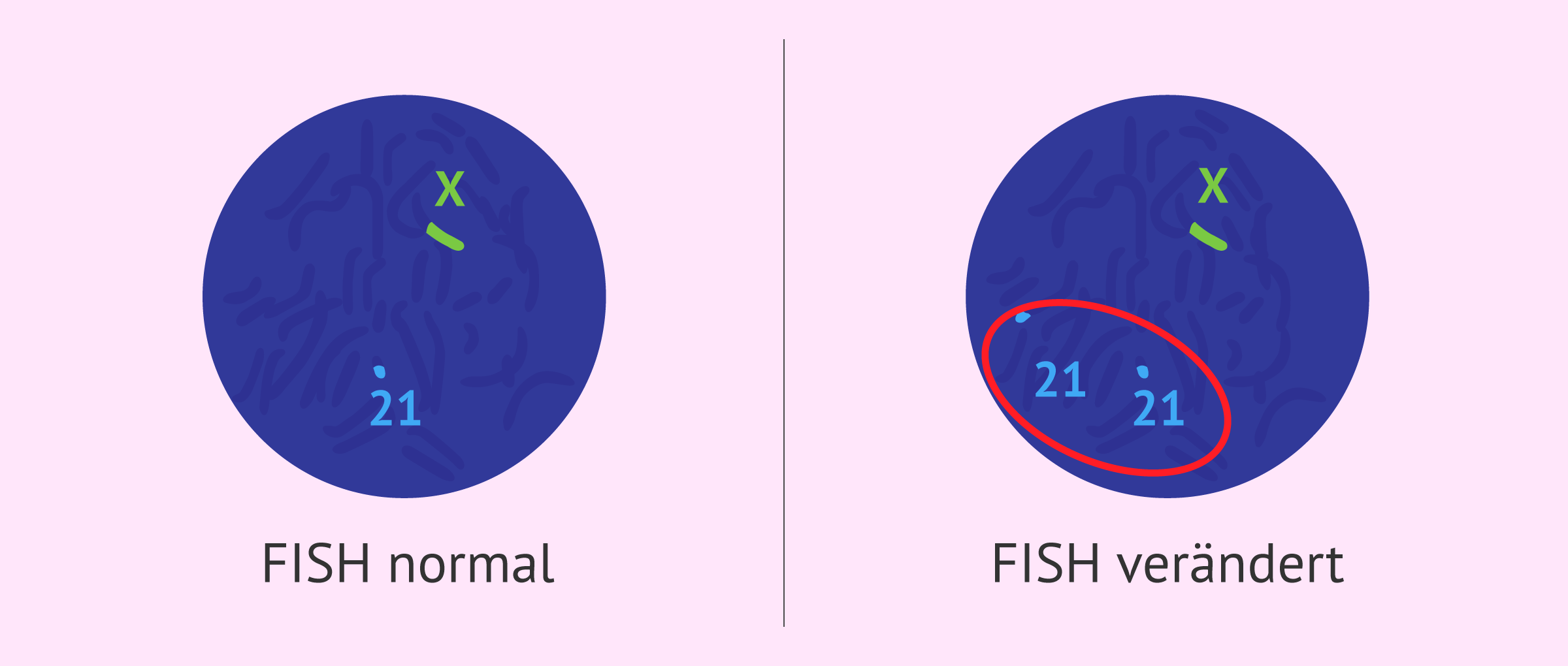 FISH-Test in Spermien