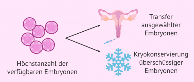 Imagen: Embryotransfer am dritten Entwicklungstag