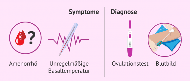 Imagen: Anovulation