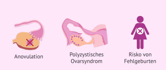 Imagen: Auswirkungen von Übergewicht auf die weibliche Fruchtbarkeit