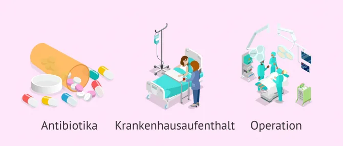 Imagen: Behandlungsarten bei PID