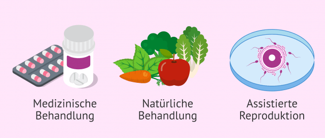 Imagen: Verschiedene Behandlungsmöglichkeiten bei Infertilität