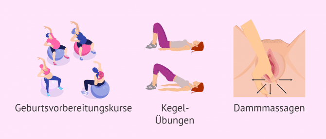 Imagen: Tipps um Dammschnitt vorzubeugen