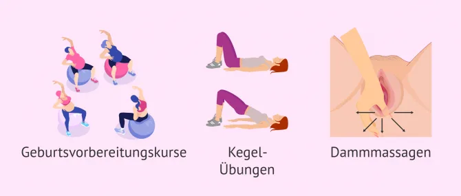 Imagen: Tipps um Dammschnitt vorzubeugen