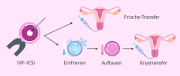 Der Kryotransfer: Wie hoch ist die Erfolgsrate bei tiefgefrorenen Embryos?
