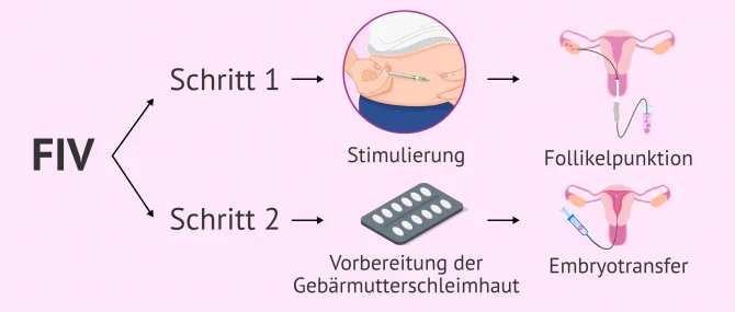 Der Kryotransfer: Wie hoch ist die Erfolgsrate bei tiefgefrorenen Embryos?