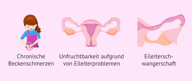 Imagen: Welche Komplikationen kann eine Salpingitis verursachen?