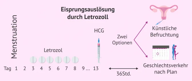 Imagen: Behandlungsvorgaben um bei PCO Eisprung auszulösen