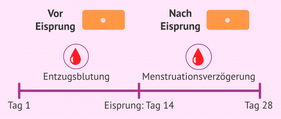 Pille Abends Genommen Am Nächsten Tag Durchfall Die Pille danach: Wirkungsweise und Kosten