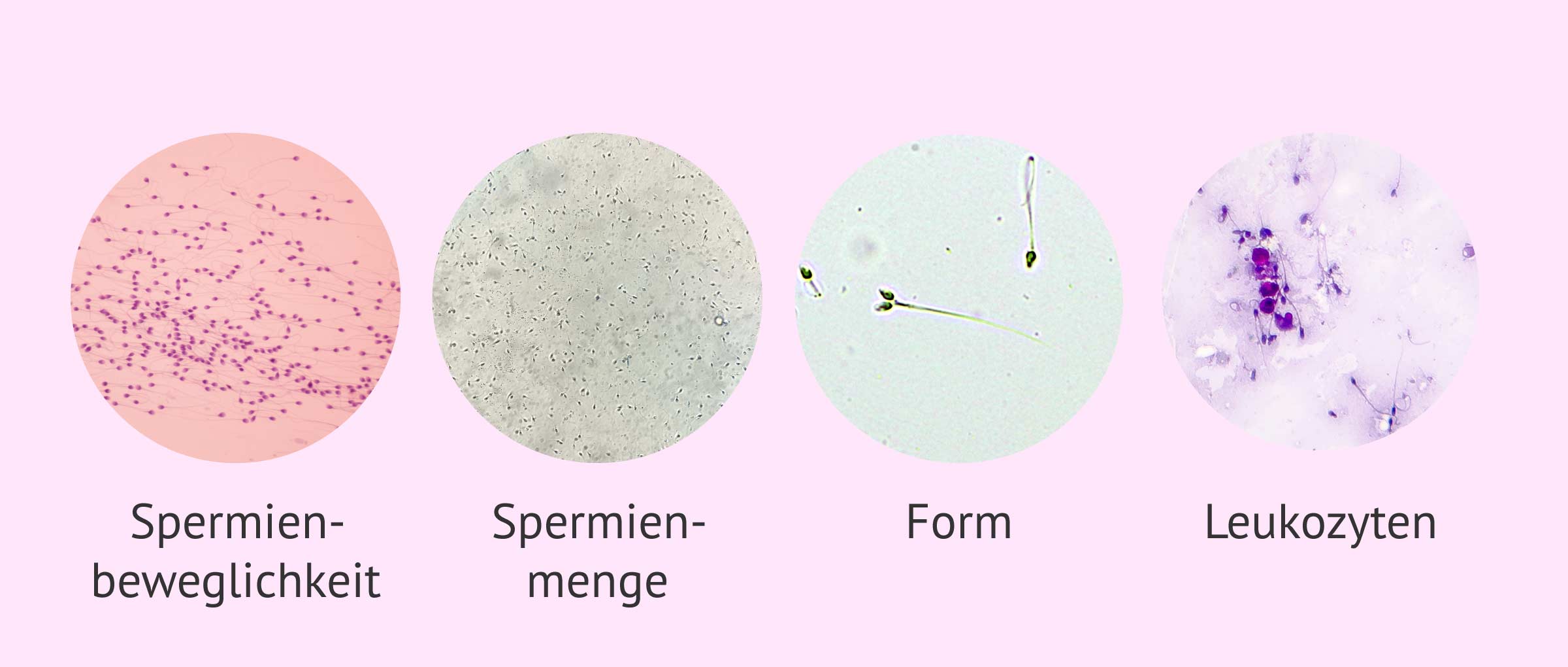Mikroskopische Parameter einer Samenanalyse