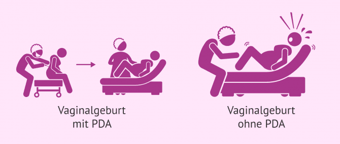 Imagen: Natürliche Geburt PDA