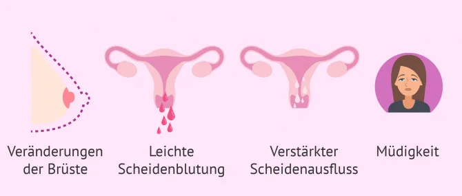 Wenn die Periode ausbleibt: Erste Schwangerschaftsanzeichen