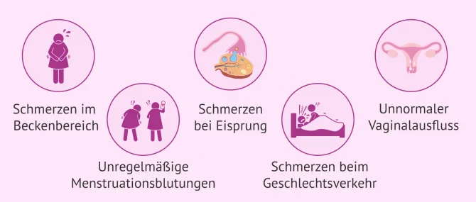 Imagen: Symptome bei Salpingitis