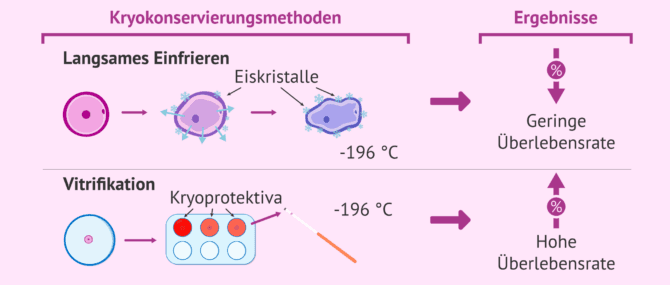 Imagen: Überlebensrate von Eizellen nach der Kryokonservierungsmethode
