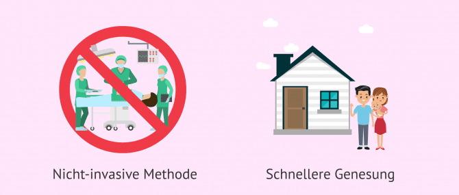 Imagen: Vorteile natürliche Geburt