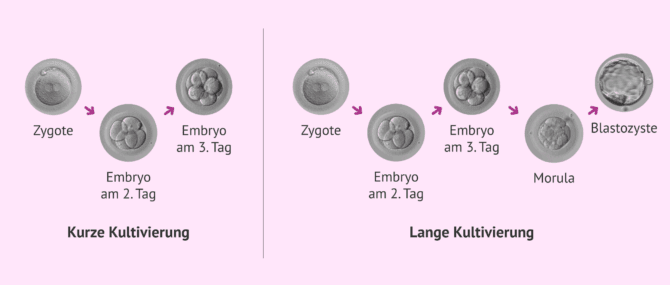 Imagen: Welche Arten von Embryonenkulturen gibt es?