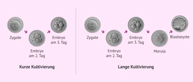 Imagen: Welche Arten von Embryonenkulturen gibt es?