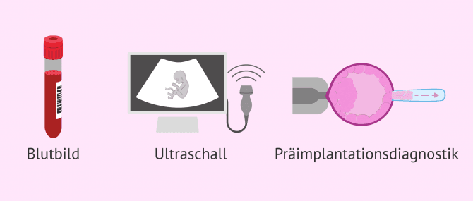 Imagen: Blutbild Ultraschall PID