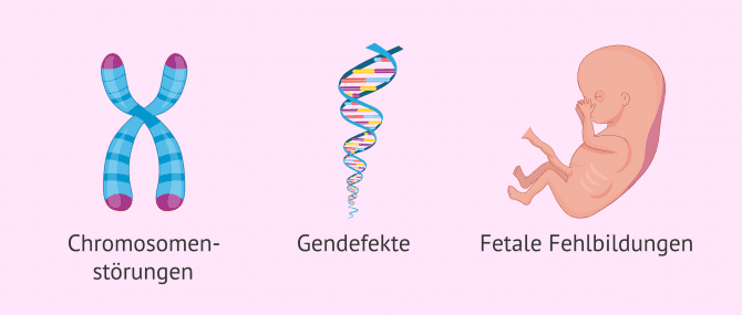 Imagen: Fruchtwasseruntersuchung zur Festellung von Problemen
