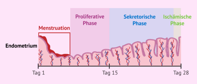 Imagen: Ischämische Phase des Menstruationszyklus