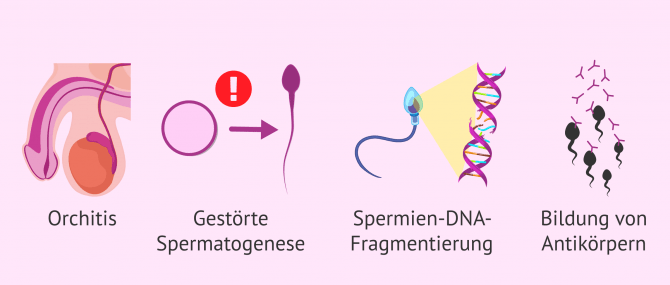 Imagen: Symptome von STD bei Männern