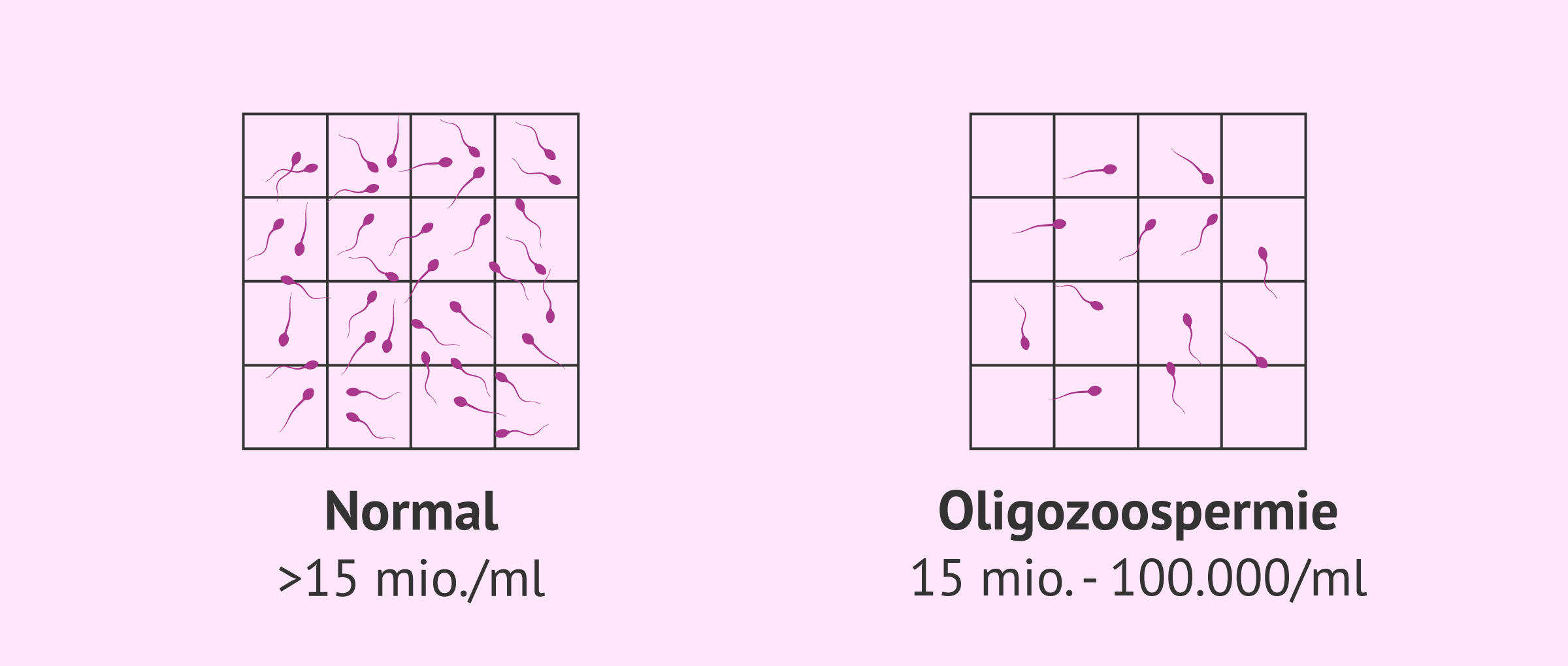Normale Probe und Probe mit Oligozoospermie