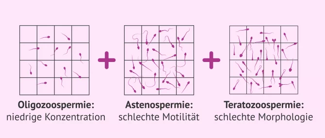 Imagen: Was ist eine Oligoasthenotheratozoospermie?
