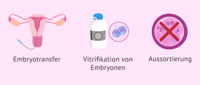 Imagen: Optionen während der Embryonenkultur